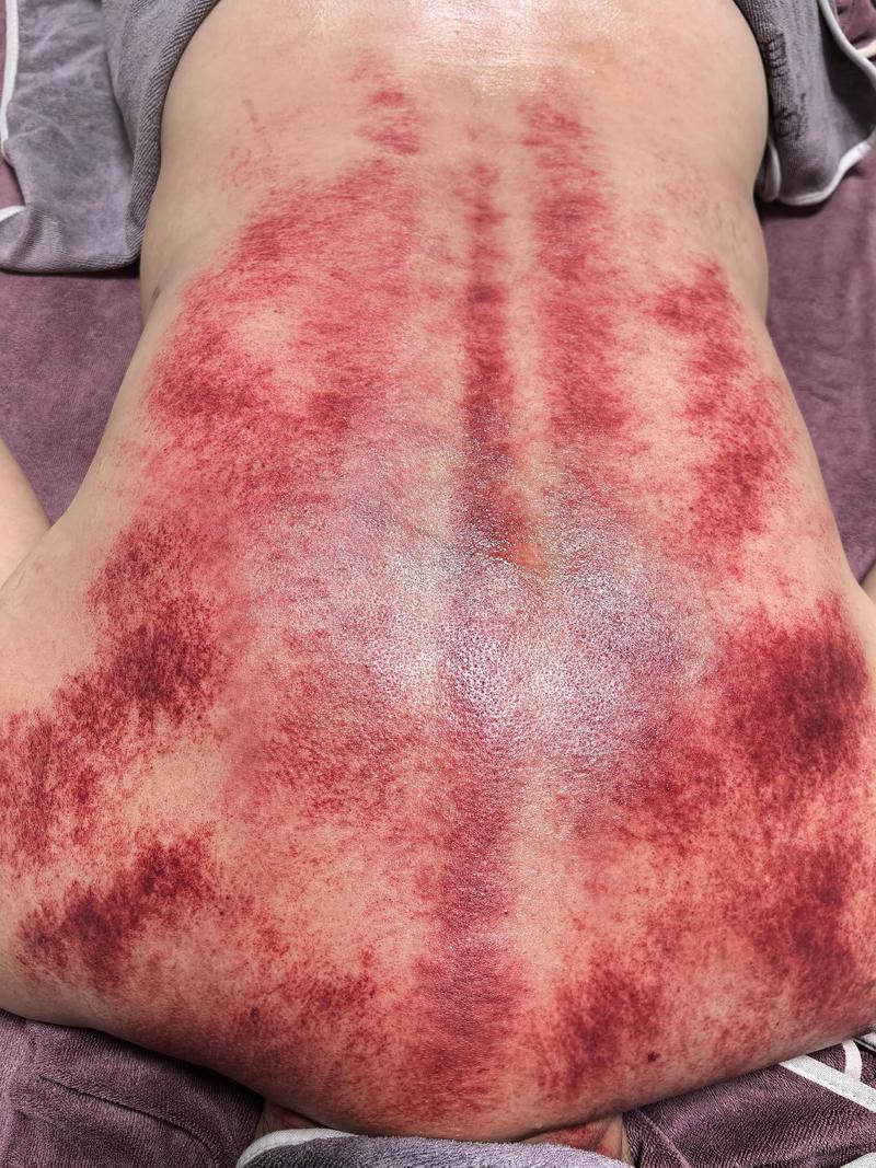 香薰SPA:缓解压力的艺术