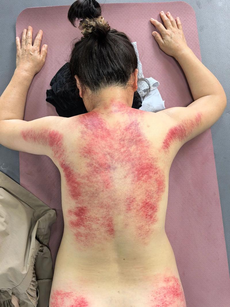 中医推拿：在日常中找寻健康